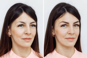istockphoto 1191255725 612x612 1